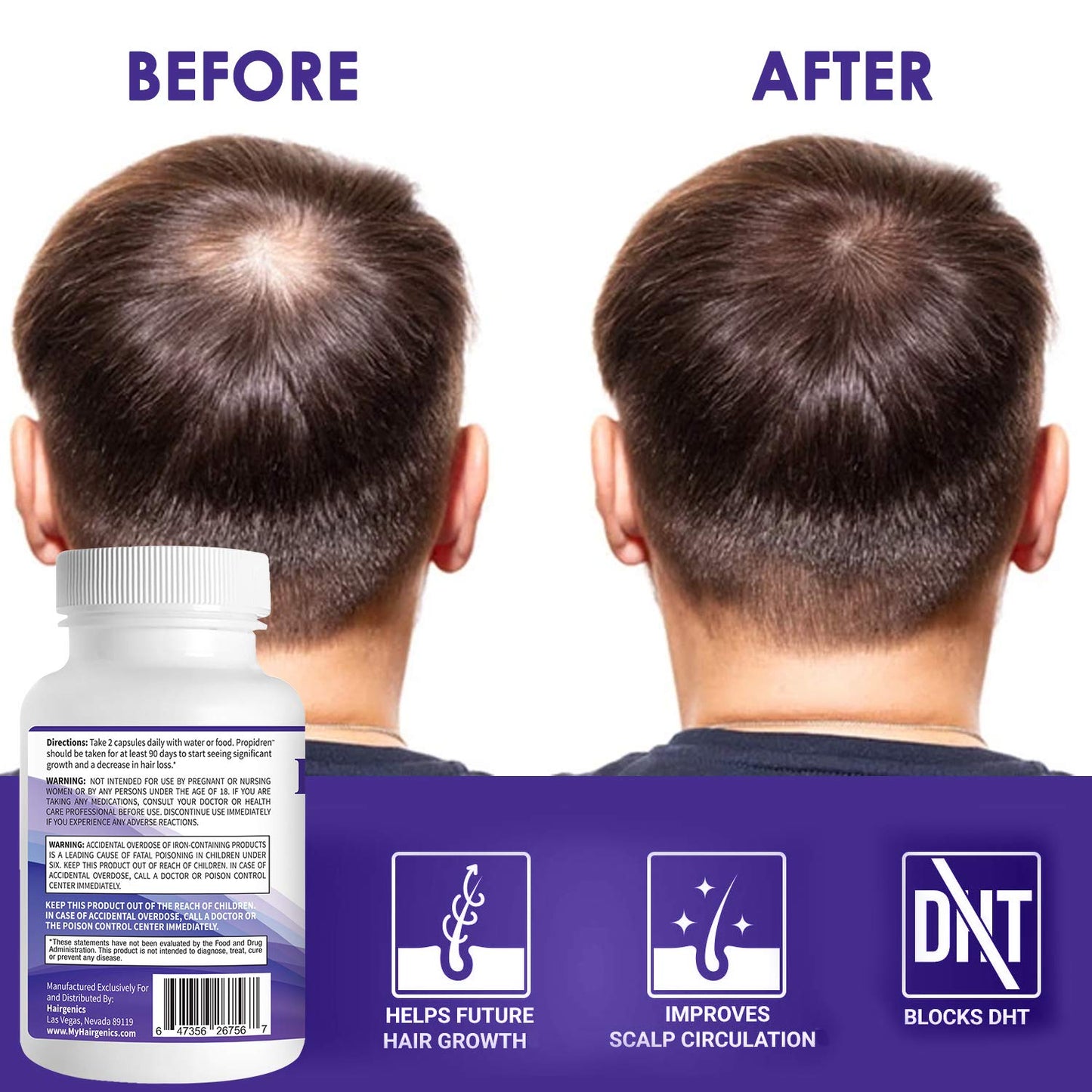 Propidren DHT Blocker with Saw Palmetto Hair Growth Supplement 60 Caps