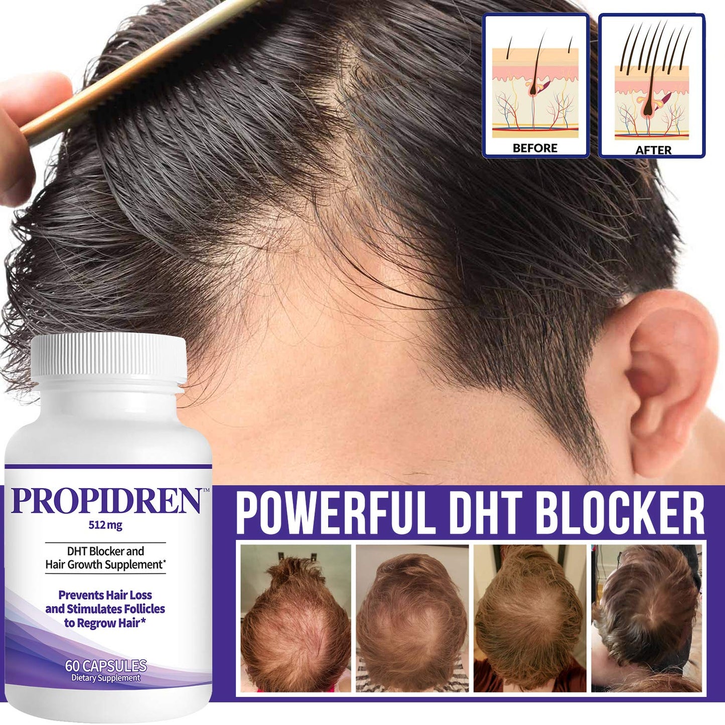 Propidren DHT Blocker with Saw Palmetto Hair Growth Supplement 60 Caps