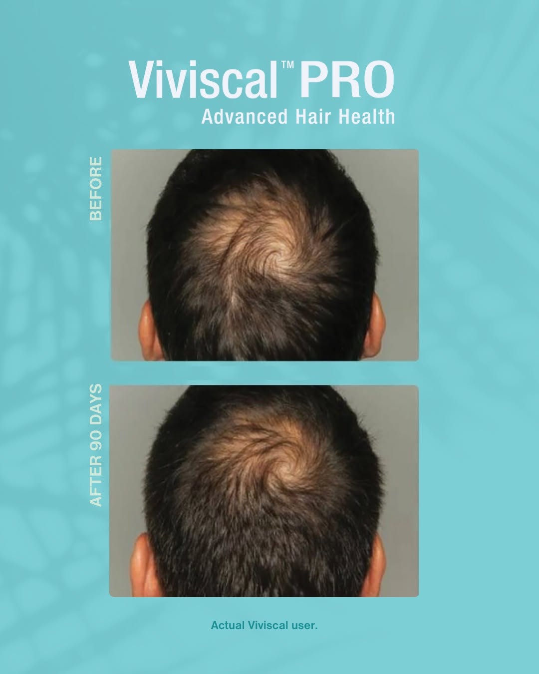 Viviscal Professional PRO Thickening Shampoo/Conditioner/Elixir 250ml