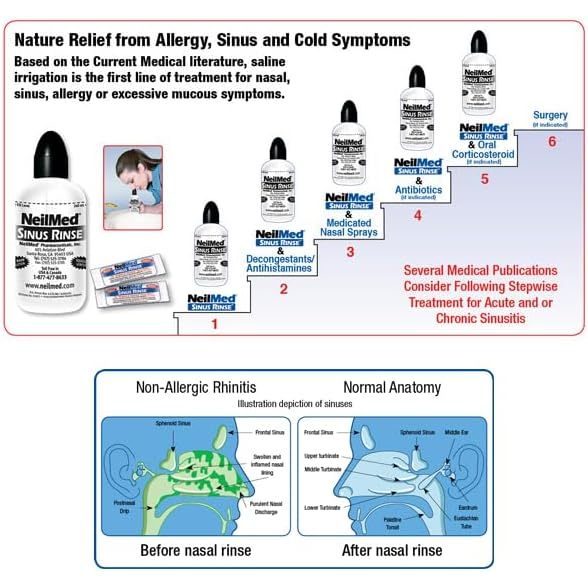 Neilmed Sinus Rinse Combo Kit 250 Packs + 2 Squeeze Bottles + 1 Saline Spray 75ml