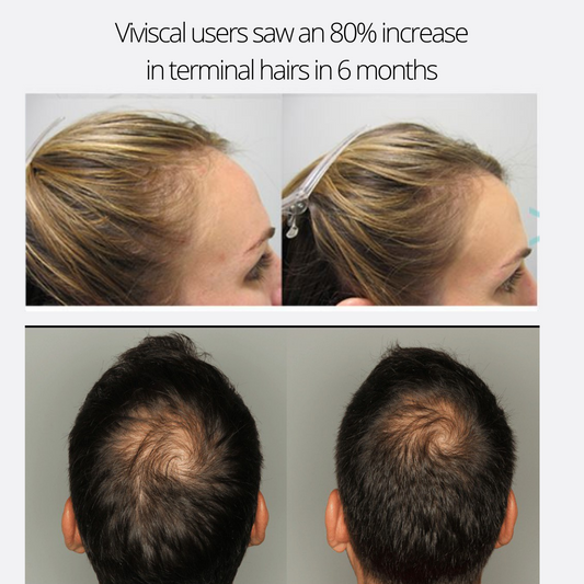 Viviscal Extra Strength Women/Men 60/180 Tabs (Hair Growth Supplements)
